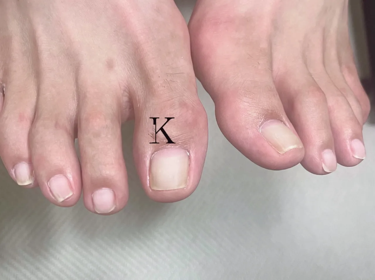 【新小岩】メンズフットネイル 【KLARIZZEパラジェル登...